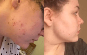 Happy Face arctisztító maszk™ <br>A zöld tea erejével 4+2 (108 alkalmas) photo review