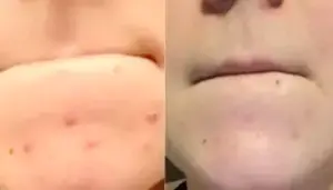 Happy Face arctisztító maszk™ <br>A zöld tea erejével (18 alkalmas) photo review